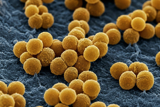 Air Cleaner for MRSA Infection Control