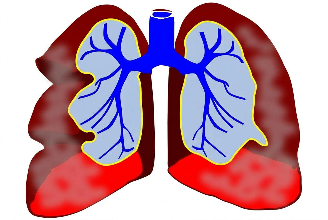 Occupational Asthma - Should Employers Do More?