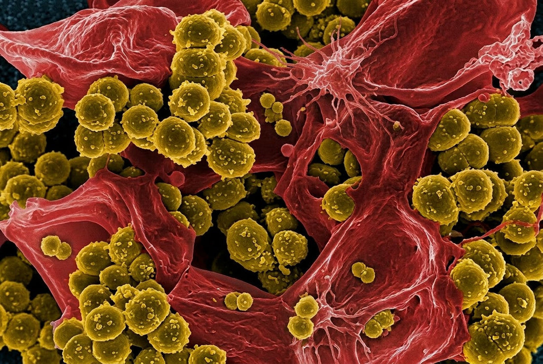 MRSA Infection Control in Hospital Settings