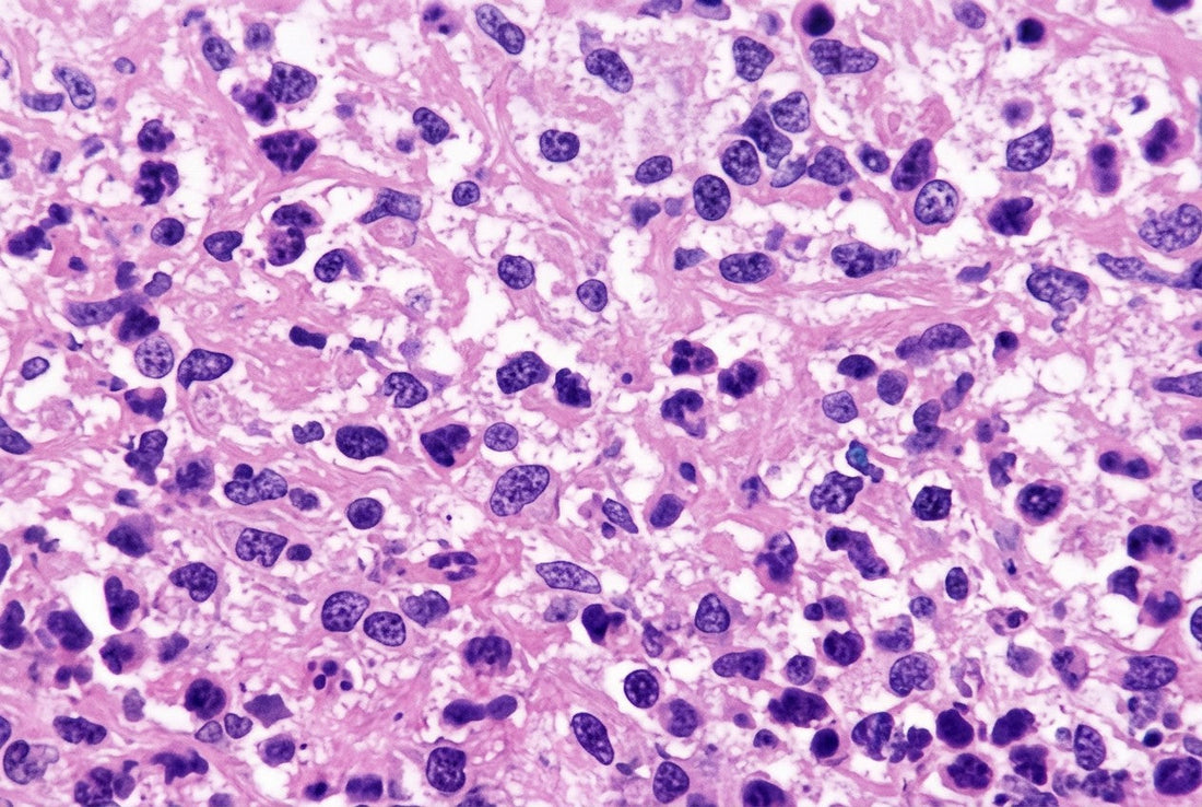 Mycobacterium Abscessus Infection Control