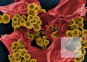 MRSA Infection Control in Hospital Settings